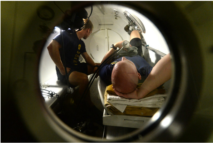 Hyperbaric Chamber for Decompression Sickness Treatment