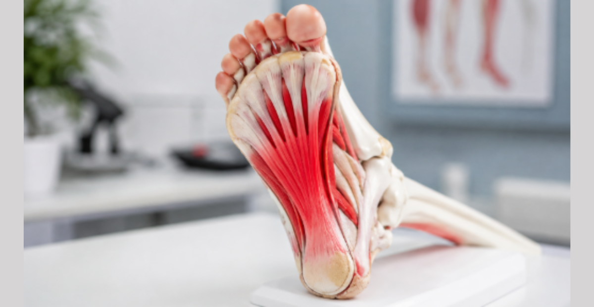 hbot for plantar fasciitis