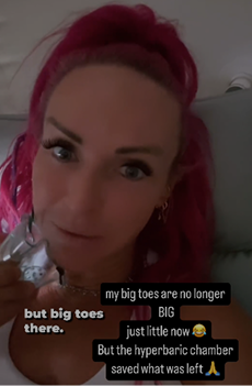 Woman with bright pink hair reclines inside a hyperbaric chamber, smiling at the camera while holding a small item, with text overlay about reduced big toe pain.